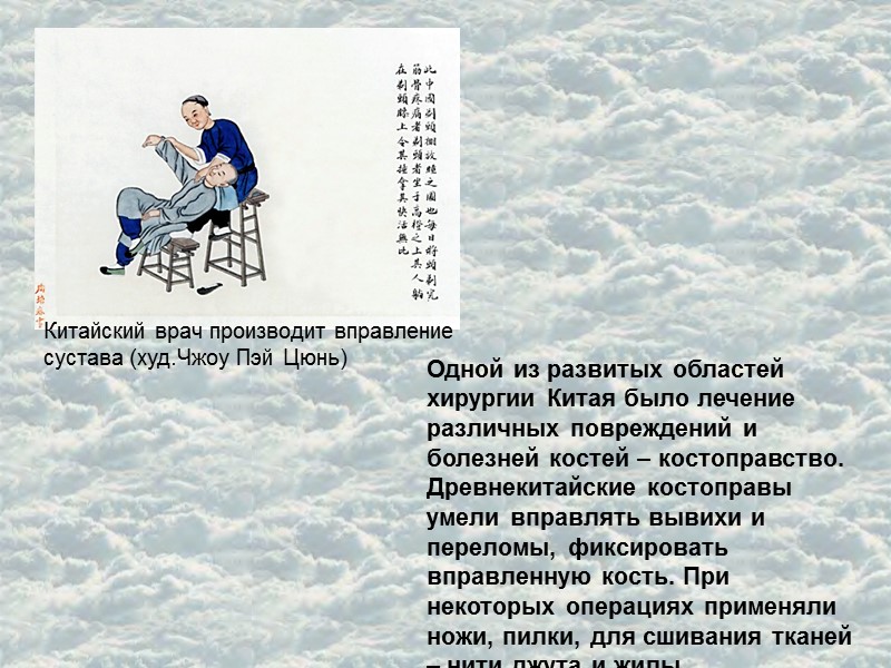 Китайский врач производит вправление сустава (худ.Чжоу Пэй Цюнь) Одной из развитых областей хирургии Китая